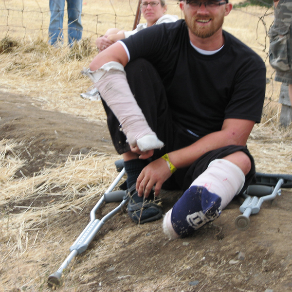 I came all the way from Australia to break an arm and leg - but you should see the dude who broke a femur