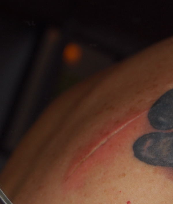 Day 1- No pictures- got totally spanked. Nice cut by my board on my shoulder- ouch