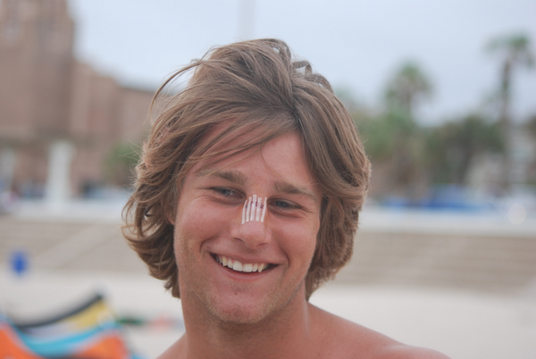 Injuries - Sam Medysky (from Nitinat and Canada) took a board to the nose just before the freestyle on Day 2 and ending up in the ER getting 5 stitches instead of kiting.