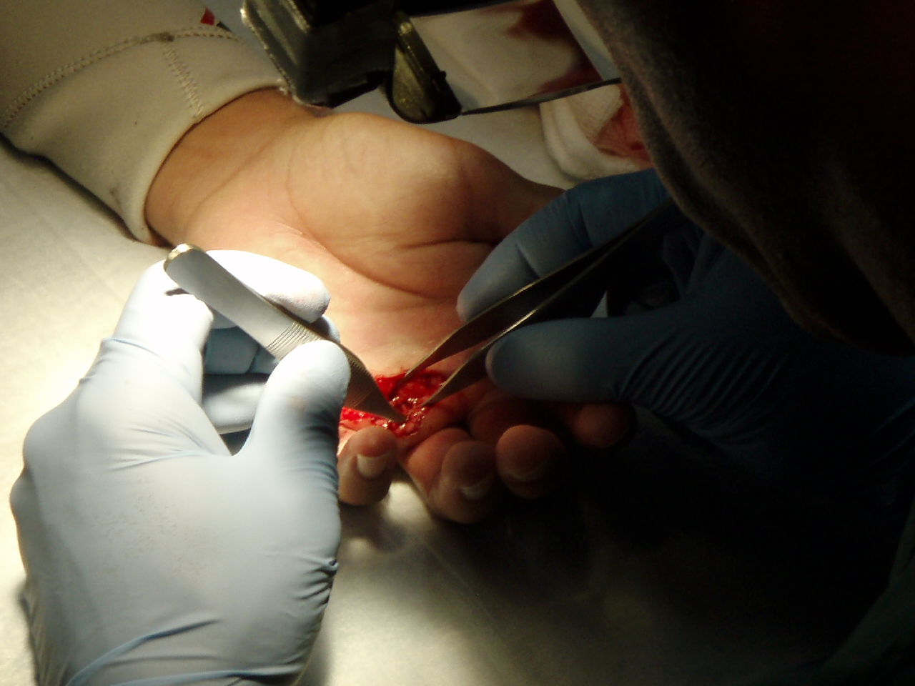 this one is gross...